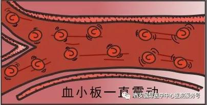 【科普】血小板是正常值的三倍？專家提醒小心血栓和出血！