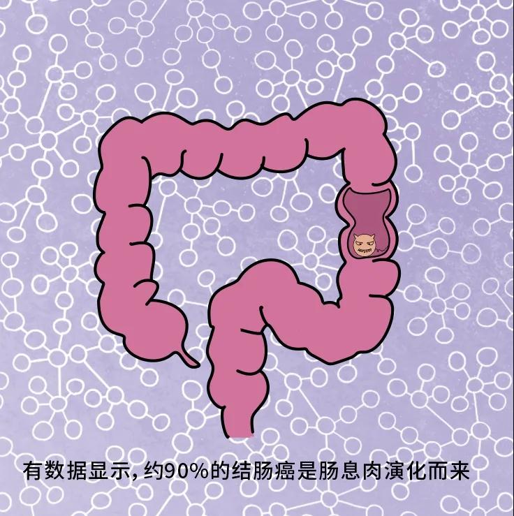 奪走“黑豹”生命的結(jié)腸癌，到底什么來頭？