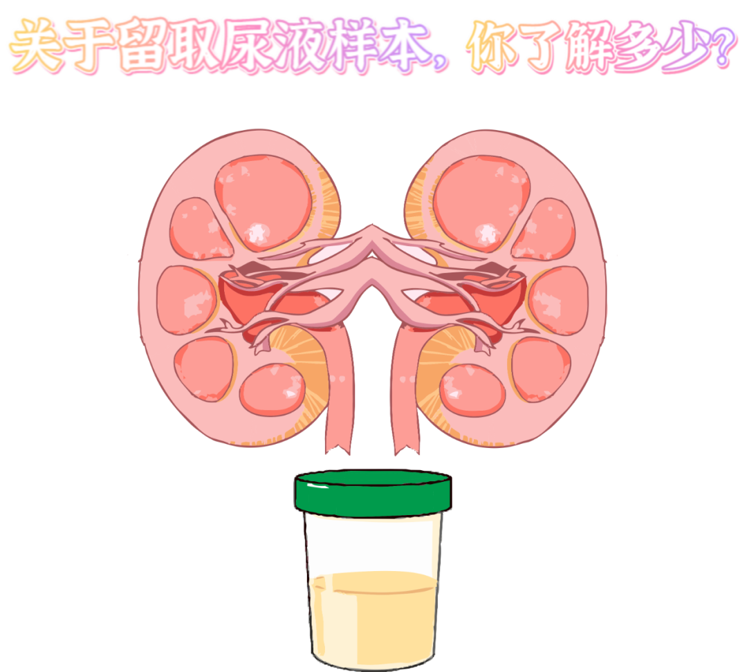 做尿檢，不得不說的注意事項(xiàng)！
