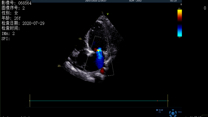 心電圖異常，心臟卻沒事，罪魁禍?zhǔn)资恰?>
				             </a>
                <div   id=