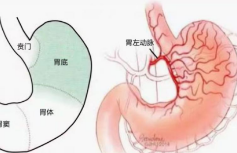不開刀不吃藥不餓肚子，微創(chuàng)介入減肥靠譜嗎？