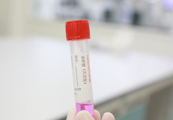 支原體感染檢測手段知多少？