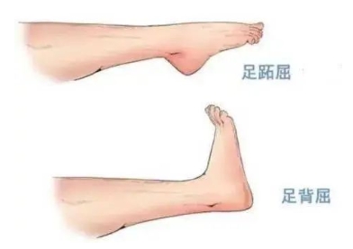 扭胯小連步、動(dòng)感搖花手……“科目三”雖火，運(yùn)動(dòng)損傷也要防！