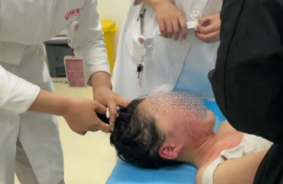 14歲，面、頸、胸燙傷，只因中午那鍋面湯…