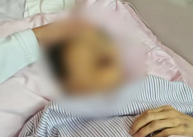 病房突發(fā)意外：老人痛苦拔管后，監(jiān)護儀瘋狂報警